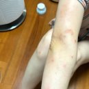 경희광제한의원 이미지