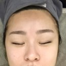 어진동_세종비지니스센터 | 세종 어진동 피부관리 썬라이더 세종센터 피부관리샵 후기