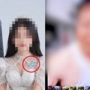 문신·성병 숨긴 베트남 아내가 앞니 부숴…결혼 석달만 숨진 50대 이미지
