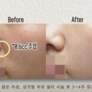 스토리피부과의원 네이버블로그