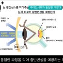 눈길안경 이미지