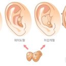 경산보은보청기