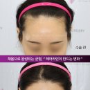 모앤라인성형외과의원 네이버블로그