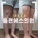 네오 | 명동 을지로 명동다이어트약 엠스컬프네오 체험 후기