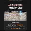 스마일 | 스마일라식후기에서 보이지 않는 중요한 기준