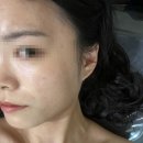 제10회 정기연주회 | 전주 송천동 피부관리 온결에스테틱 솔직후기