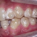 인비스치과의원 이미지