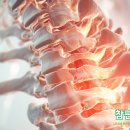 편한허리신경외과의원 네이버블로그