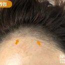 향헤어라인