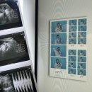 세화산부인과의원 | 수원 베스트 산부인과 출산 전 37주 2일 마지막 진료