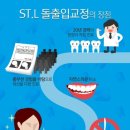루이스치과 네이버블로그