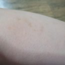 한국한센복지협회경기인천지부부설의원 이미지