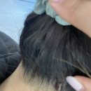 다시봄의원 | [웨딩일기] W.16 예신 관리 리스트에 추가해야 할 것 - 방서동 더봄의원 사마귀제거 냉동치료 후기