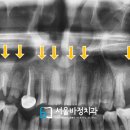 서울바정치과의원 이미지