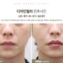 허니즈의원 이미지