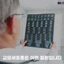 의사가 뽑은 최악의 암 췌장암보다 무서운 암 바로 '이것' 이미지