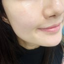 더마리턴5