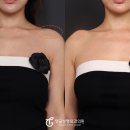 탱글성형외과의원 이미지