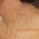 소예피부과의원 이미지