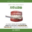 명학하나치과의원 네이버블로그