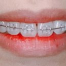 푸른나무치과의원 이미지