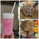 담석 제거 수술 후기 :: 담낭 제거 후 회복 후기 :: 수술 후통증, 식사 후기