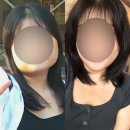 사적인아름다움지유의원 | 사적인아름다움지유의원 사각턱보톡스 내돈내산 8개월 후기!