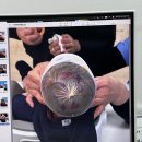 이노야드 두상교정센터 석촌호수 | 아기 두상 교정 센터 방문 후기 ㅣ 이노야드 두상 교정센터 석촌호수점