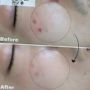 거보주유소 | 이거슨 피부고민 끝판왕 맛집, 충주모공관리 필수 코스라구!