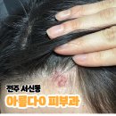 부송아름다운피부과의원 | 피부염 전주 병원 어디가 좋을까? 아름다0 피부과 솔직 방문 후기