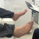 레푸스동래 | 동래발톱무좀, 레푸스 동래점에서 문제성 발톱 관리 후기