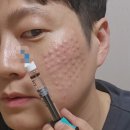 건강한뇌신경과의원 | 양주 피부과 리쥬란, 잘하는 곳은 무엇이 다를까요?