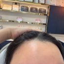 정자역 왁싱 추천] 분당 잘하는 곳 찾는다면? 라이콘스파에센셜 블랑레니왁싱! - 헤어라인왁싱 솔직후기