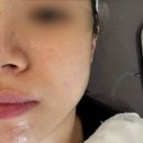 여의도롯데엠파이어캐슬화장실 | 여의도역 피부관리는 에이스킨 압출부터 LDM기기관리까지 받고온 솔직후기