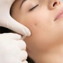 한림피부과의원 | 지축역피부과 리투오가 핫한 이유는? 요즘 스킨부스터 차이 정리