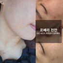 르베라천안점 | 천안 피부장벽관리 르베라 피부전문센터 천안점에서 속건조 문제해결