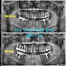 서울유플란트치과의원 이미지