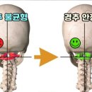 동안피부관리실 네이버블로그