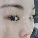 푸른메디케어 | 부천 신중동 피부관리 오늘,더뷰티 모공디톡스 솔직후기
