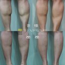 리뉴미피부과의원 이미지