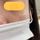 아마존PC | [아마존 직구] 시카케어 실리콘 겔 시트 아마존 직구...실리콘 겔 효과 솔직후기 (전후 사진 있음)