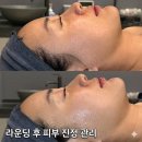 새한메디칼 | 전주 르클레어 피부케어｜햇빛에 예민해진 피부 수분진정 관리 후기