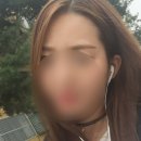 진자헤어라인 | 7일차 여자 헤어라인 모발이식 후기 구렛나루 모발이식 내돈내산 솔직후기 m자이마 2900모 절개 비용...