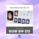 유앤박미래피부과의원 | 색소부터 여드름, 모공까지 압구정 피부과 마크뷰 셀프 진단 후기, 꼭 필요한 이유?