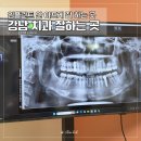 강남역치과 추천, 치과 트라우마 극복하고 성인 유치 임플란트 받은 후기