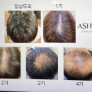 라비브 두피관리 송도 타임스페이스 아슈드헤어살롱 재방문 독소관리 후기