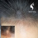 한올눈썹탈모커버 아카데미본점 | 일산 대화동 흉터커버, 상처는 지우고 자신감은 채우는 기술