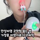 에스의료기 | 가정용 비염치료기 코에픽 만성비염 코막힘 뚫는법