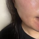 트로이샵 | 강동역피부샵 @지에스테틱 / 트로이필 피부관리 솔직후기