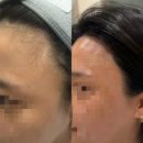 디와이샵 | 청주율량동 왁싱 바디관리 헤어왁싱 피부관리 잘하는 가성비좋은 뷰티샵 디와이뷰티